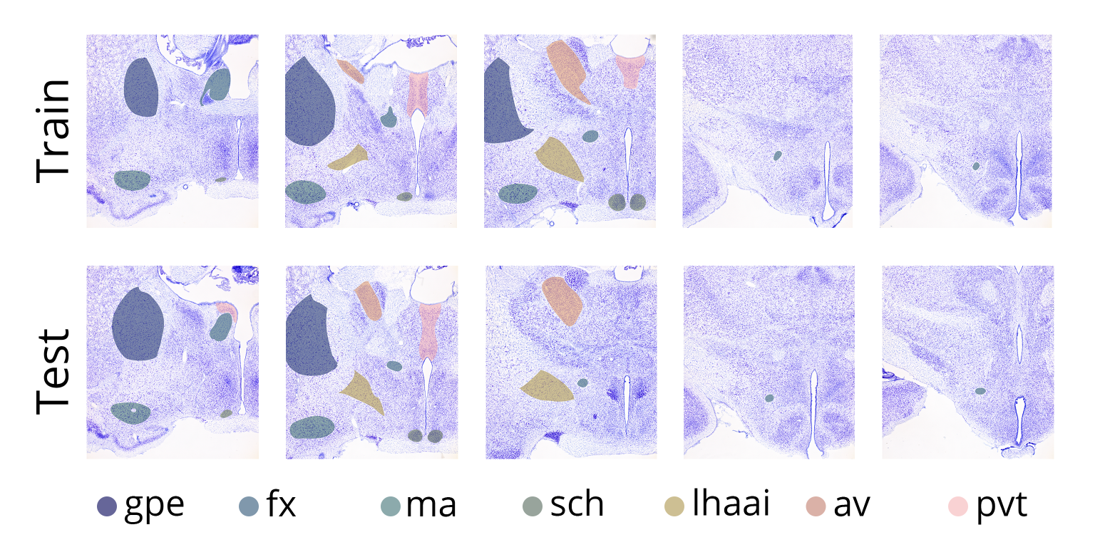 Images with segmented brain regions